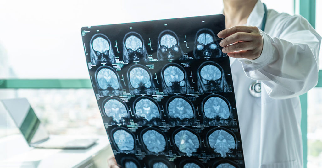 Médica verificando placas para identificar trastornos del desarrollo neurológico 