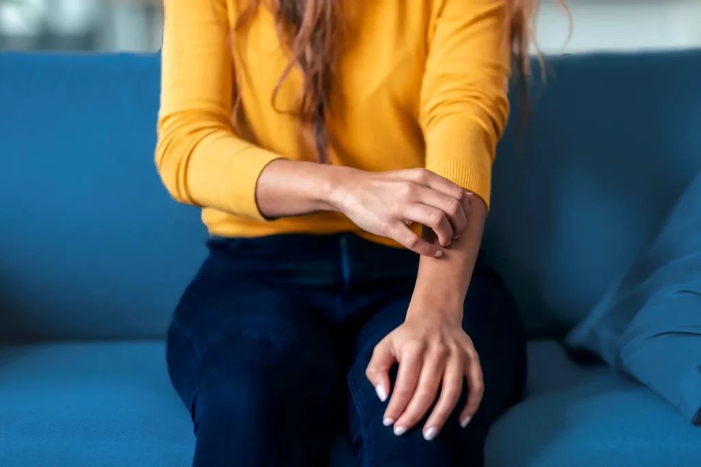 Mujer sentada en un sillón rascándose el brazo debido a la psoriasis que ha desarrollado