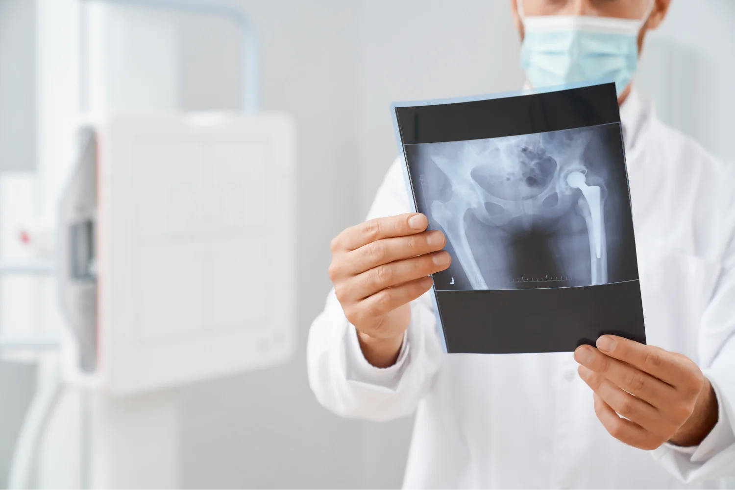 Traumatólogo revisando revisando una radiografía de un reemplazo total de cadera con prótesis. 