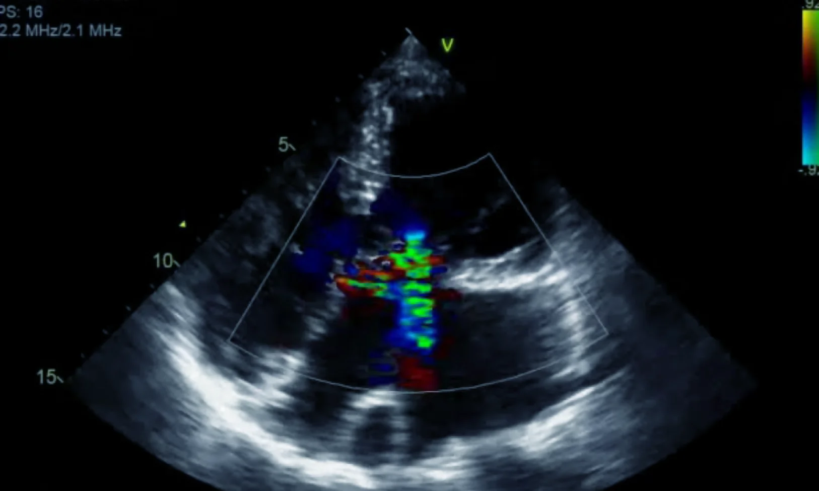 Curso de cardiopatías congénitas del adulto “Desde la clínica hasta la imagen multimodal”