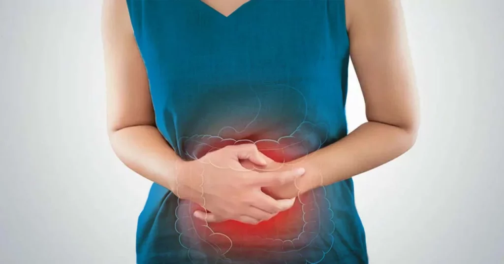 Mujer con brazos en el abdomen y un dibujo del intestino, para señalar que el cáncer de colon se cura.